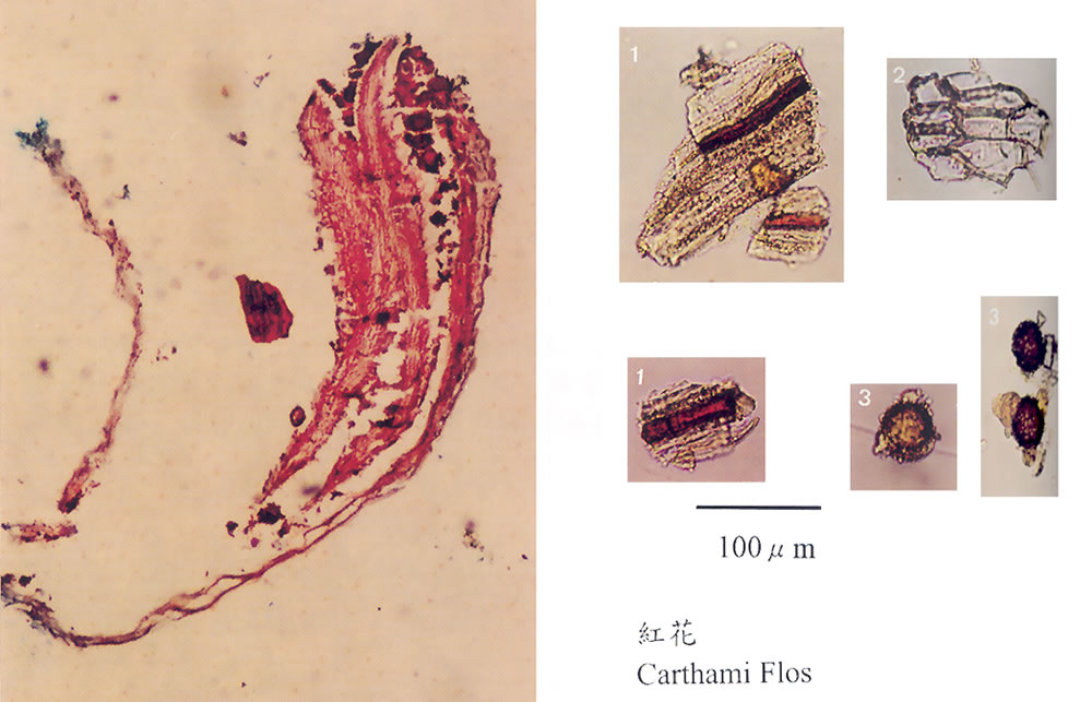 Electron microscopy